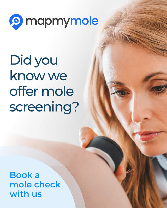 Map my mole in Orten Waterville, Peterborough